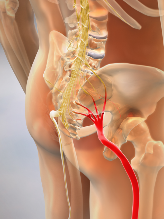 Sciatica nerve pain