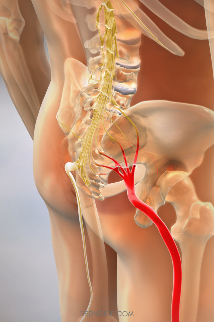 Sciatica nerve pain