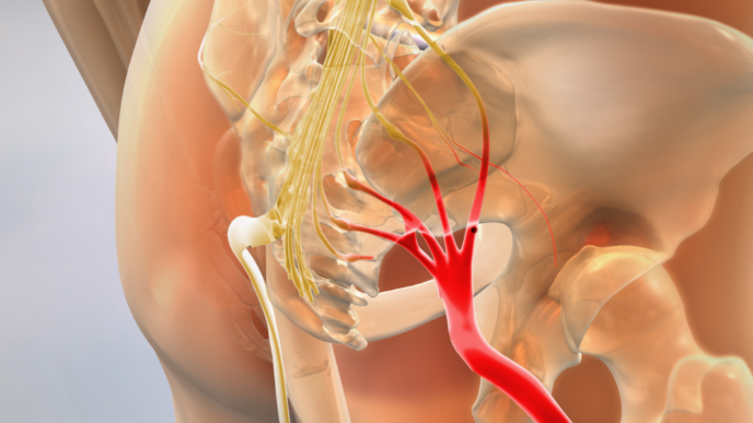 Sciatica nerve pain