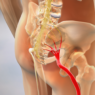 Sciatica nerve pain